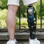 A person wearing white shorts and sneakers stands near a fence, showing a prosthetic leg.