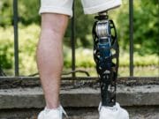 A person wearing white shorts and sneakers stands near a fence, showing a prosthetic leg.