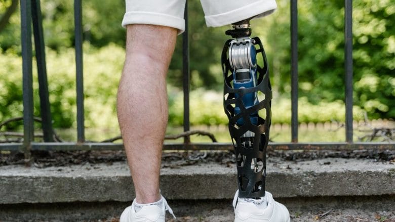 A person wearing white shorts and sneakers stands near a fence, showing a prosthetic leg.