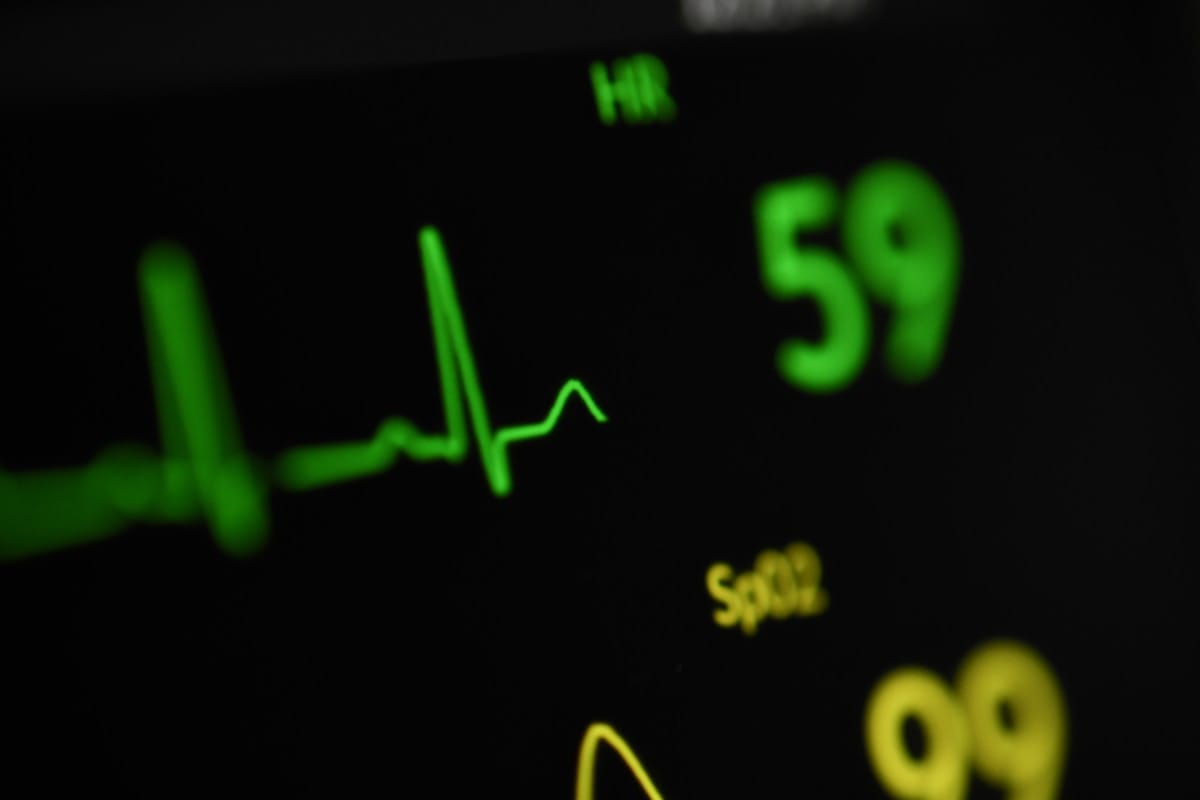 Close-up of a medical monitor displaying a heart rate of 59 bpm and a SpO2 reading of 99.